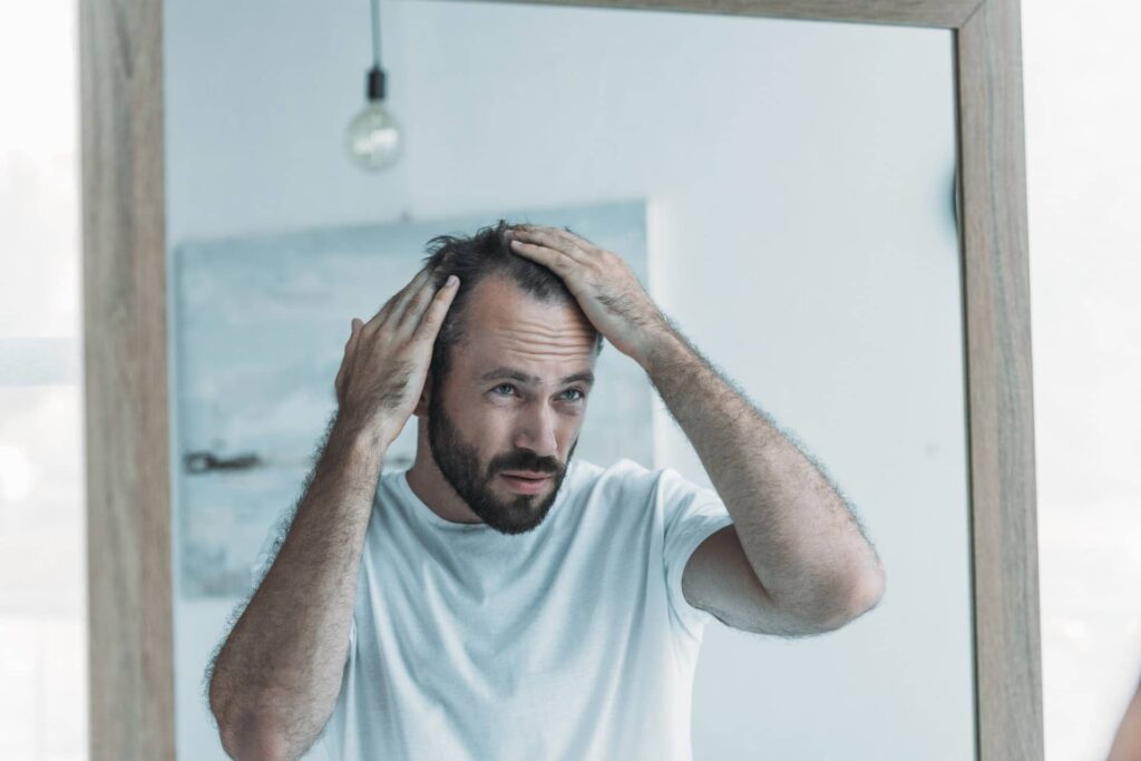 לנצח את הגנטיקה טיפול בהתקרחות גברים